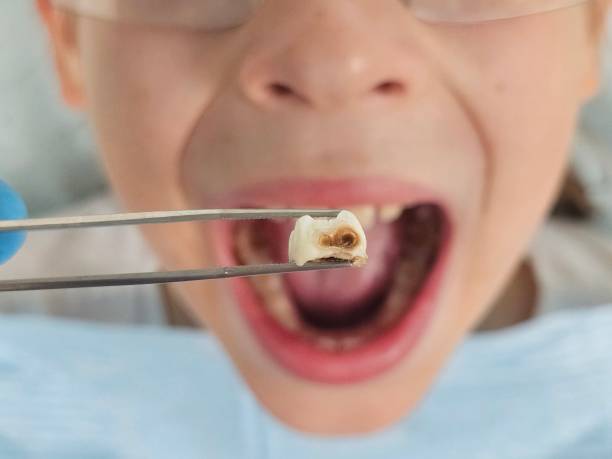 Best Same-Day Emergency Dental Services in Garden City, MO